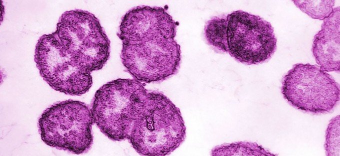 Bild av gonorrébakterier