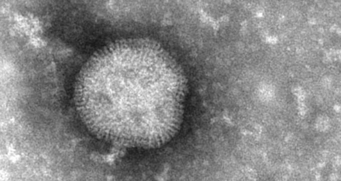 Elektronimikroskop influensavirus